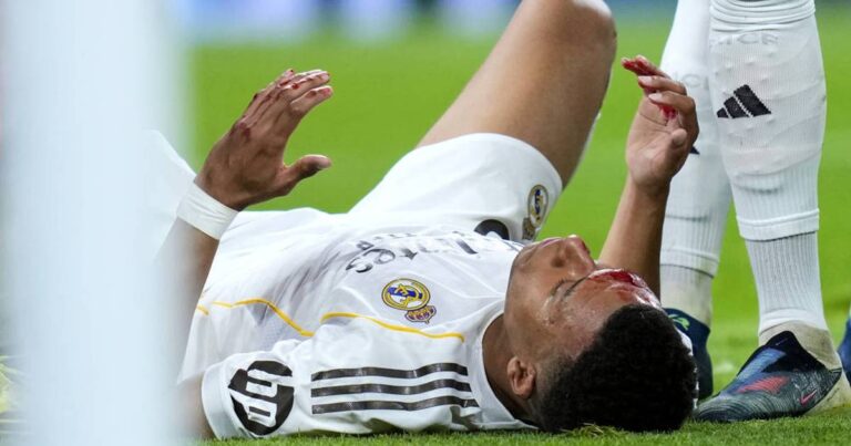 Real Madrid spielt nur Unentschieden gegen FC Girona